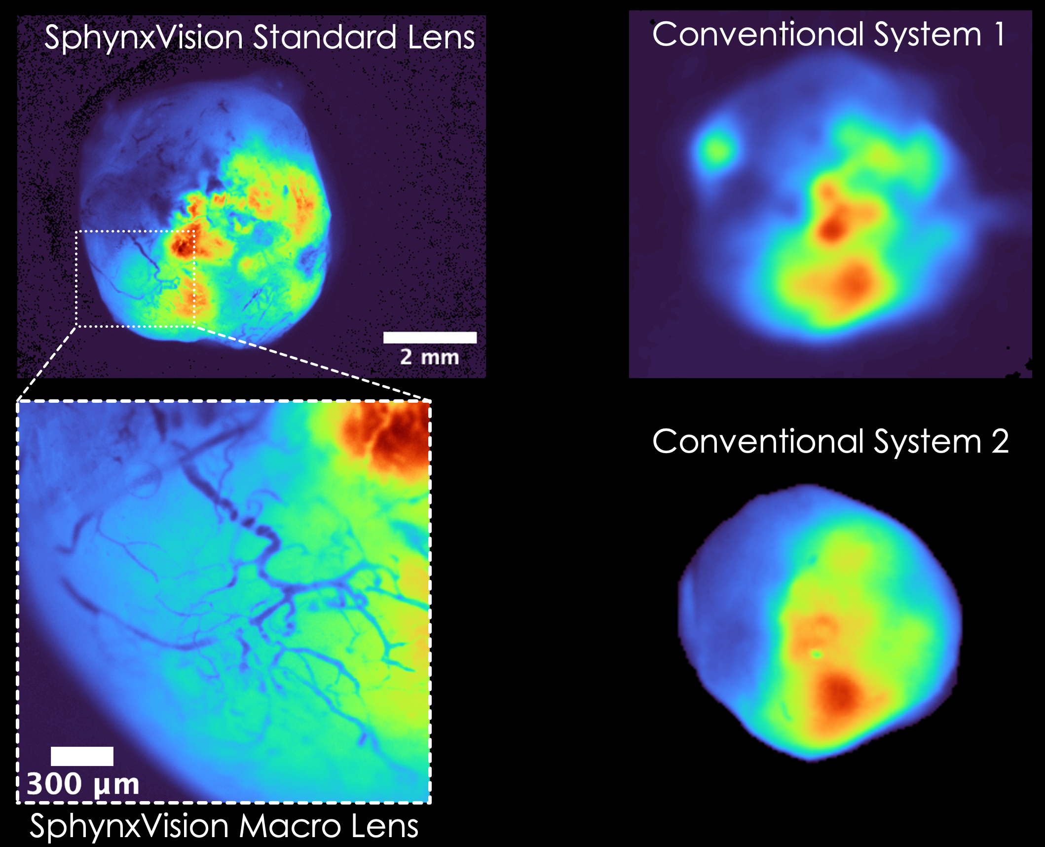 Ex vivo GFP-labeled tumor comparison: SphynxVision versus two conventional imaging systems
